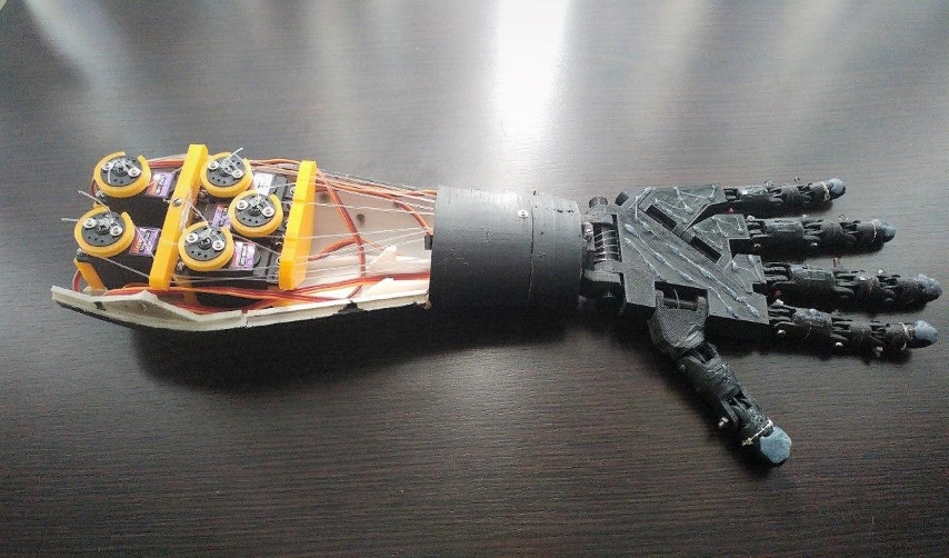 robotics prosthetic arm